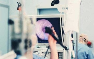 Opto-Line specializes in providing the highest quality apertures for medical endoscopes and laparoscopes.